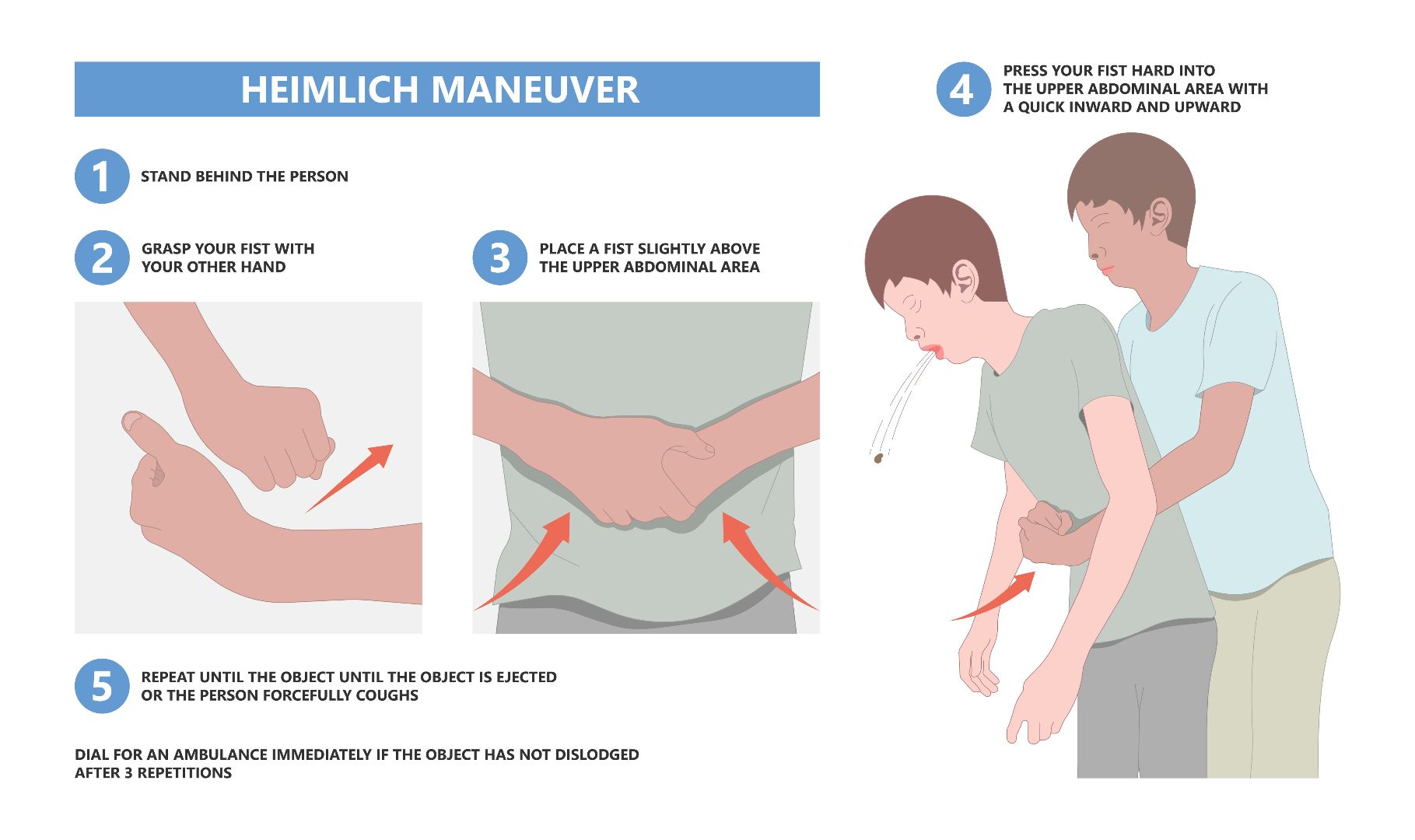 Heimlich Maneuver.jpeg