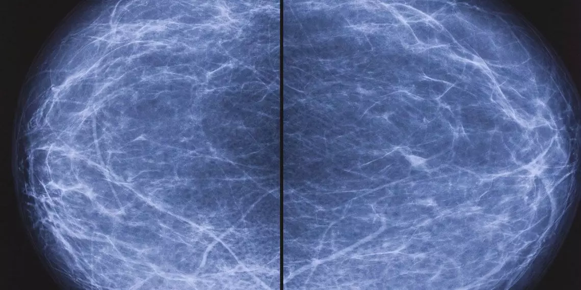 Mammogram-Results-Image.jpg