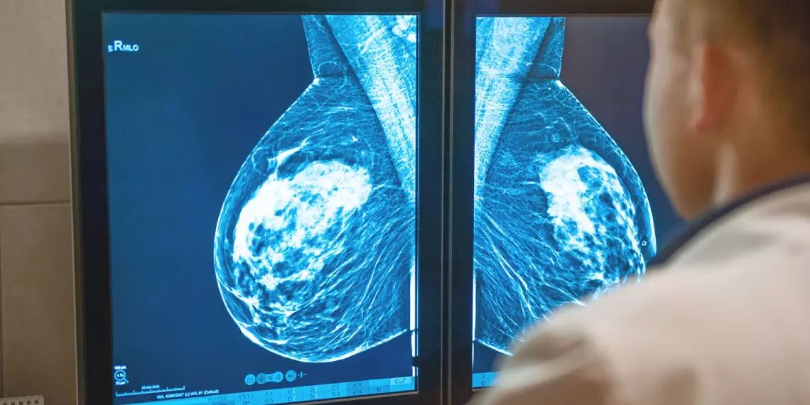 Mammogram-image.jpg
