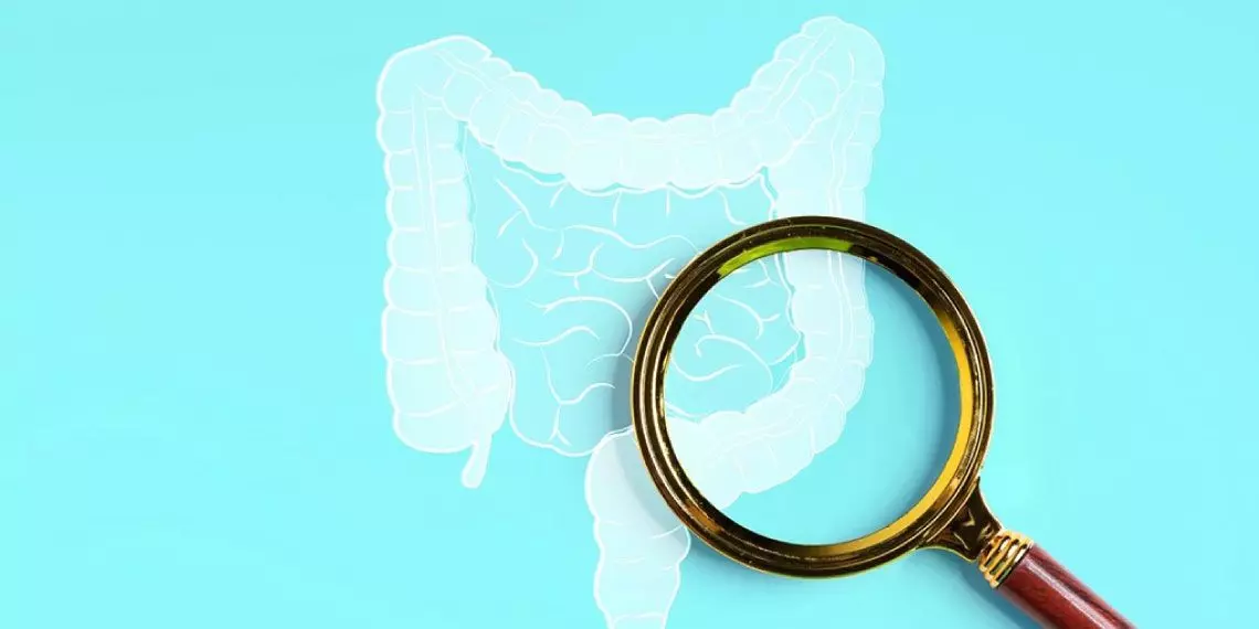 understanding colon cancer screening tests