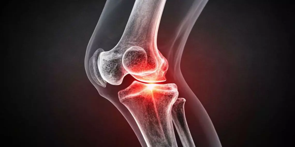 Knee joint inflammation during cold weather