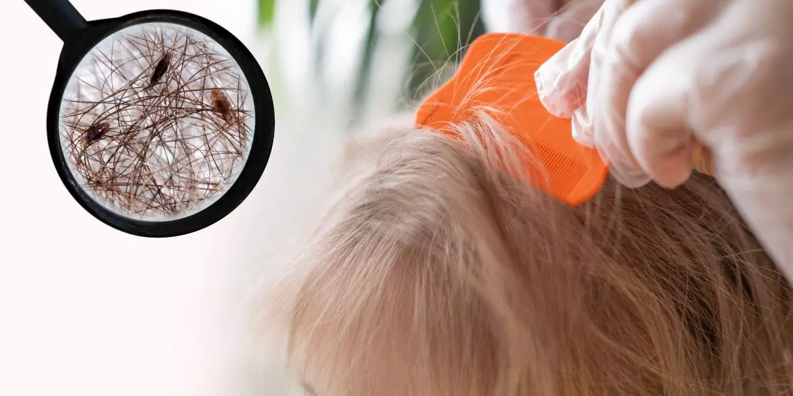 Image-1--head-lice-under-magnifying-glass-on-child-scalp.jpg